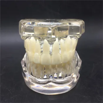 Žmogaus Dantų anatomijos laboratoriniai dantų anatomija mokyti smegenų modelis dovana implanto kainos kaukolė įranga
